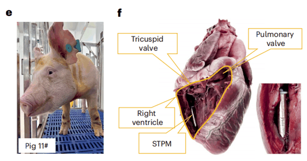 （来源：https://doi.org/10.1038/s41551-025-01604-4）