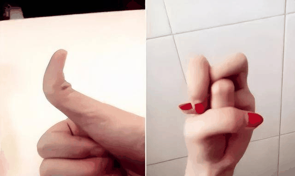 10种罕见的人体特征，拥有一个或是“天选之人”