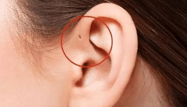 10种罕见的人体特征，拥有一个或是“天选之人”