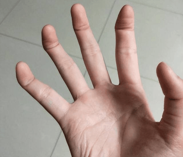 10种罕见的人体特征，拥有一个或是“天选之人”