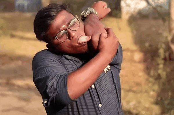 10种罕见的人体特征，拥有一个或是“天选之人”