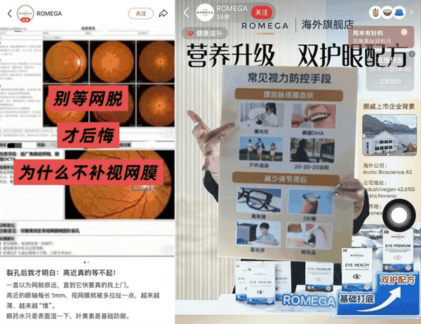 ROMEGA品牌在其社交平台账号发布大量引流笔记，主播在ROMEGA海外旗舰店直播间介绍相关产品的近视防控功效。