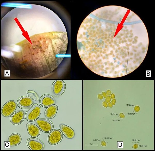 △ Austropuccinia psidii孢子