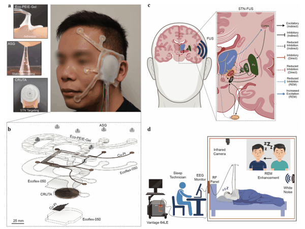 图丨 NEUSLeeP 概述（来源：Nature Communications）