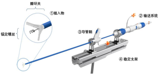 （图1：汇禾医疗的核心产品 来源 招股书）